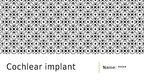 Презентация 'Cochlear Implant', 1.