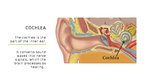 Презентация 'Cochlear Implant', 5.