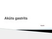 Презентация 'Akūts gastrīts', 1.