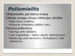 Презентация 'Poliomielīts', 3.