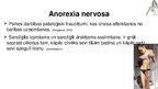 Презентация 'Anorexia nervosa (anoreksija), bulimia nervosa (bulīmija), kompulsīvā pārēšanās', 50.