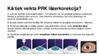 Презентация 'PRK jeb fotorefraktīvā keratometrija', 5.