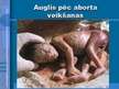 Презентация 'Aborta definīcija un abortu veidi', 4.