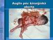 Презентация 'Aborta definīcija un abortu veidi', 6.