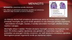 Презентация 'Neisseria meningitidis - meningokoki', 16.