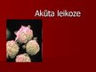 Презентация 'Akūta leikoze', 1.