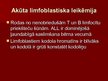 Презентация 'Akūta leikoze', 11.