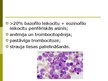 Презентация 'Hroniskas mieloleikozes raksturojums un laboratoriskā diagnostika', 10.