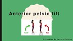 Презентация 'Anterior Pelvic Tilt', 1.