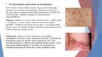 Презентация 'Herpes vīrusa mikrobioloģiskais raksturojums, vīrusa infekcijas izpausemes uz ād', 5.