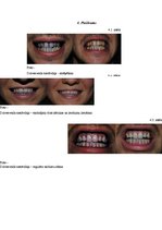 Реферат 'Zobu higiēna un tās ietekme uz zobu veselību', 36.