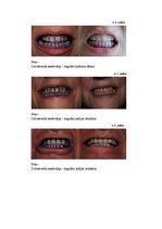 Реферат 'Zobu higiēna un tās ietekme uz zobu veselību', 37.