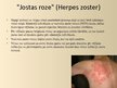 Презентация 'Herpes vīruss', 15.