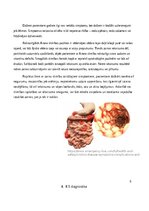 Реферат 'Krona slimība', 5.