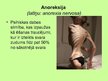 Презентация 'Sabiedrības zināšanas par bulīmiju un anoreksiju', 6.