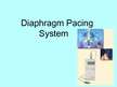 Презентация 'Diaphragm Pacing System', 1.