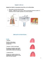 Конспект 'Izņemamās zobu protēzes balstītas, uz implantiem', 4.