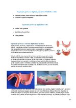 Конспект 'Izņemamās zobu protēzes balstītas, uz implantiem', 14.