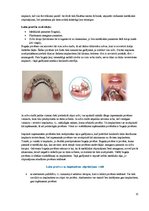Конспект 'Izņemamās zobu protēzes balstītas, uz implantiem', 15.