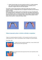 Конспект 'Izņemamās zobu protēzes balstītas, uz implantiem', 16.