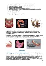 Конспект 'Izņemamās zobu protēzes balstītas, uz implantiem', 18.