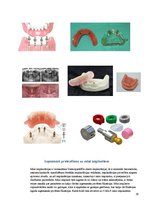 Конспект 'Izņemamās zobu protēzes balstītas, uz implantiem', 19.