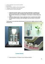 Конспект 'Izņemamās zobu protēzes balstītas, uz implantiem', 29.