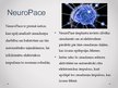 Презентация 'Mikročipu implanti smadzenēs un prāta kontrole', 6.