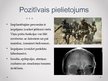 Презентация 'Mikročipu implanti smadzenēs un prāta kontrole', 7.