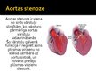 Презентация 'Aortas stenoze', 2.