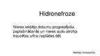 Презентация 'Hidronefroze', 1.