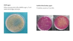 Презентация 'Escherichia coli mikrobioloģiskās diagnostikas principi', 11.