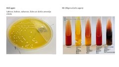 Презентация 'Escherichia coli mikrobioloģiskās diagnostikas principi', 12.