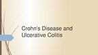 Презентация 'Crohn's Disease', 1.