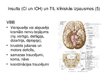 Презентация 'Akūti galvas smadzeņu asinsrites traucējumi', 17.