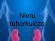 Презентация 'Nieru tuberkuloze', 1.