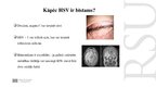 Презентация 'Kāpēc zobu higiēnistiem nekad nevajadzētu ārstēt pacientu ar aktīvu orālo herpes', 11.