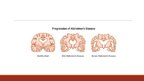 Презентация 'Alzheimer Disease', 3.