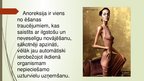 Презентация 'Anoreksija', 2.