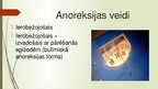 Презентация 'Anoreksija', 3.