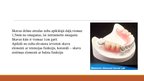 Презентация 'Izņemamās parciālās zobu protēzes ar plastmasas bāzi izgatavošanas klīniskie, la', 21.