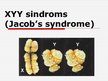 Презентация 'XYY - sindroms', 1.