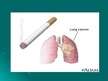 Презентация 'Smēķēšanas ietekme uz cilvēka veselību', 12.