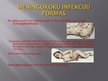 Презентация 'Meningokoku infekcija', 4.