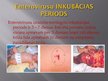 Презентация 'Meningokoku infekcija', 14.