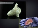 Презентация '3D printēšana medicīnā', 14.