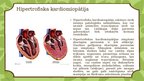 Презентация 'Kardiomiopātija Bērniem', 5.