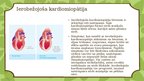 Презентация 'Kardiomiopātija Bērniem', 6.
