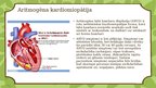 Презентация 'Kardiomiopātija Bērniem', 7.