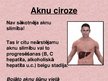 Презентация 'Aknu ciroze', 4.
